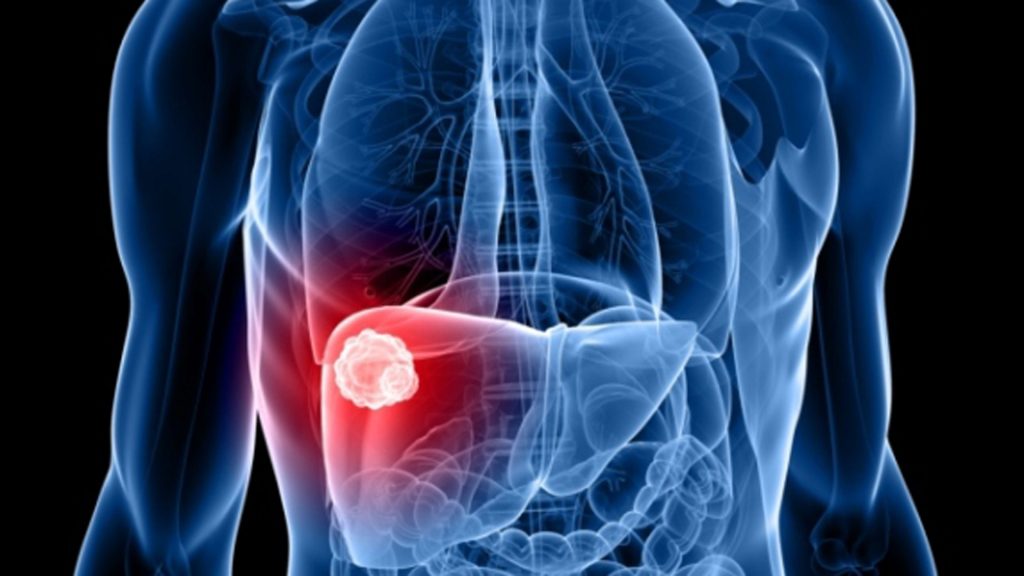 que es la hepatitis