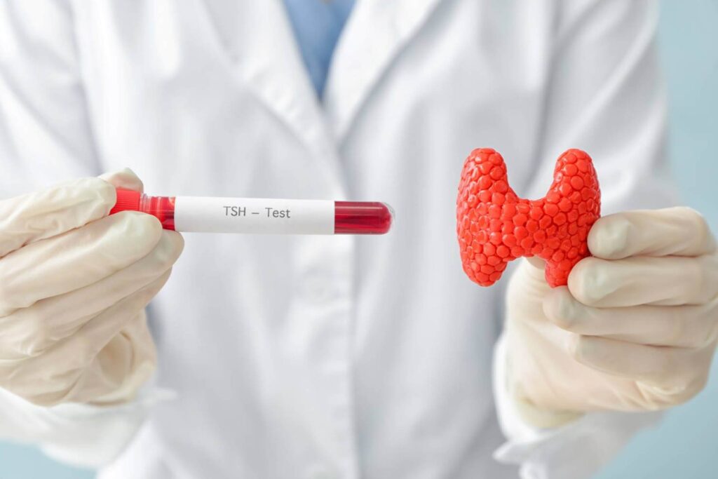 doctor con modelo anatómico de tiroides y tubo de sangre para perfil tiroideo