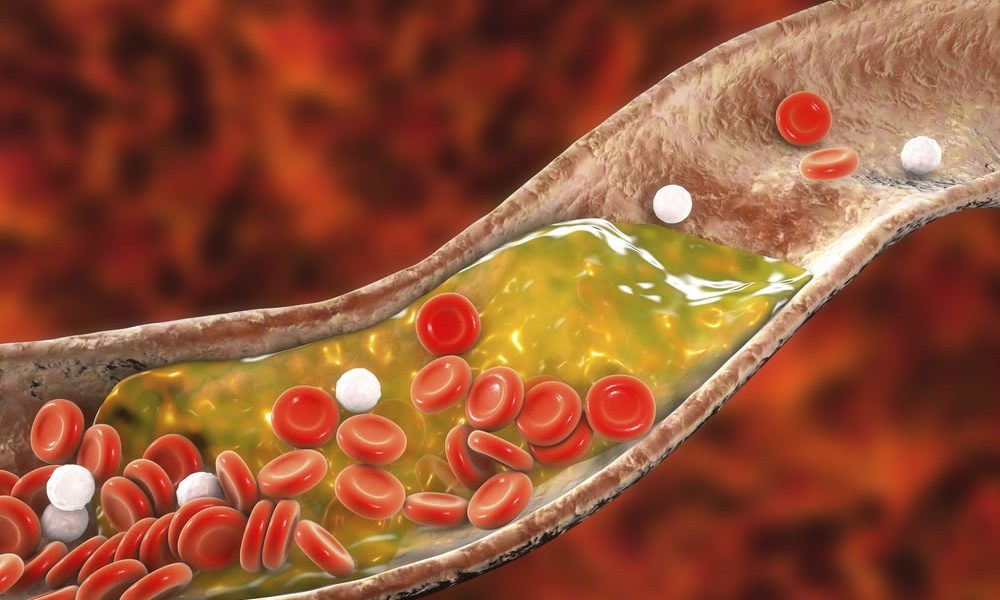 animación trigliceridos en sangre