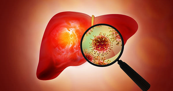 higado con hepatitis-c
