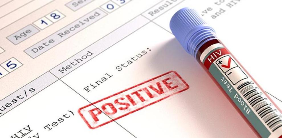 prueba de vih positivo