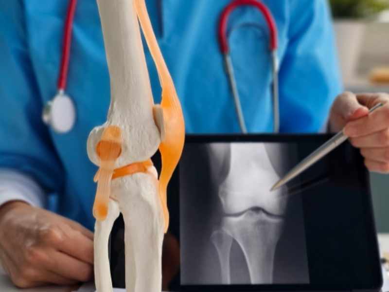 precio de la resonancia magnética de rodilla